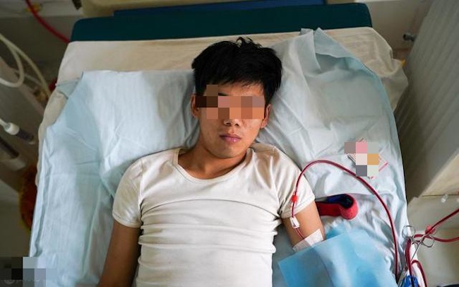 Người đàn ông nhập viện vì suy thận cấp sau cơn đau lưng (Ảnh minh họa)