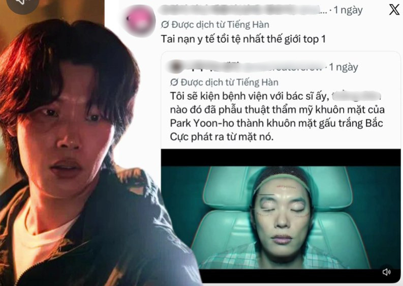 Top 1 tai nạn y tế tồi tệ nhất thế giới: Tốn tiền sửa mặt mà lại xấu đi, 7 triệu người đòi kiện bác sĩ