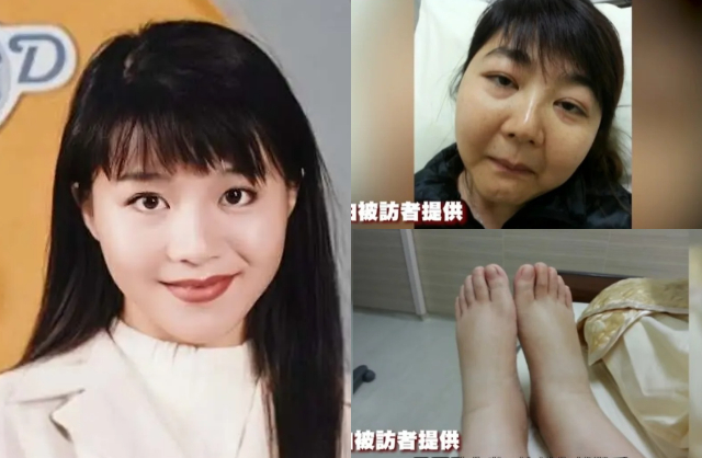 Bệnh tật khiến diện mạo của nữ diễn viên trở nên phù nề, mất đi vẻ thanh tú vốn có. Ảnh: On.