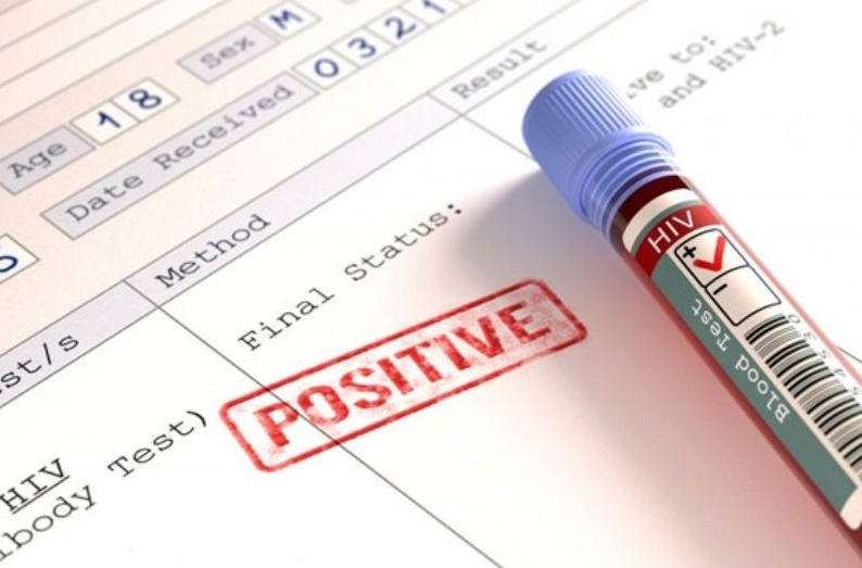 Ngoài vết thương hở, HIV có thể lây nhiễm qua niêm mạc mắt, mũi, miệng, cơ quan sinh dục (Ảnh minh họa)