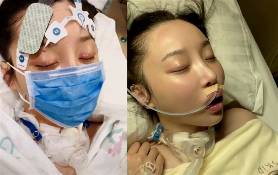 Nữ diễn viên bị hôn mê, rơi vào trạng thái người thực vật hơn 3 tháng. Ảnh: Sohu.