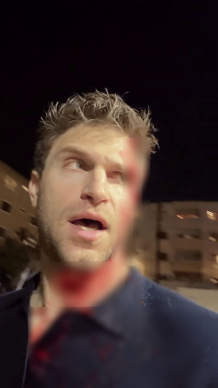 Keegan Allen bị 2 tên cướp hành hung và cướp đồng hồ. Ảnh: Page Six