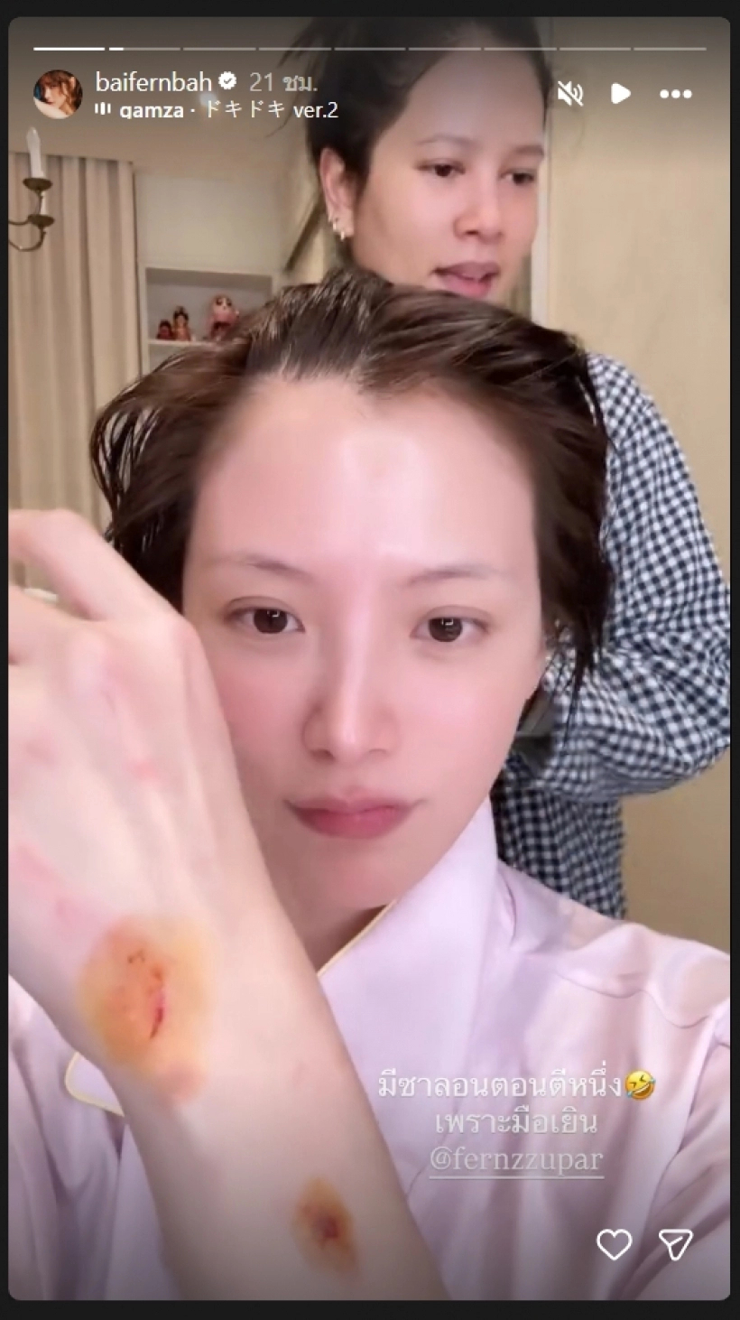 Gallery - Tình trạng thê thảm của Baifern sau khi bị ép chia tay Nine Naphat - image 2