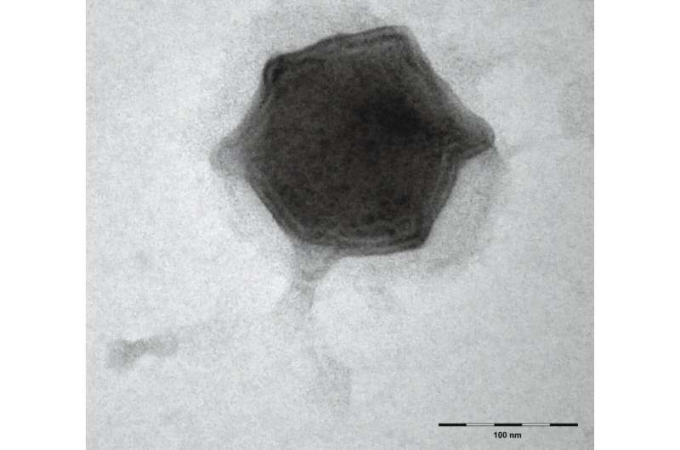 Hình ảnh virus Budvirus qua kính hiển vi điện tử. Nguồn: Trung tâm Sinh học CAS