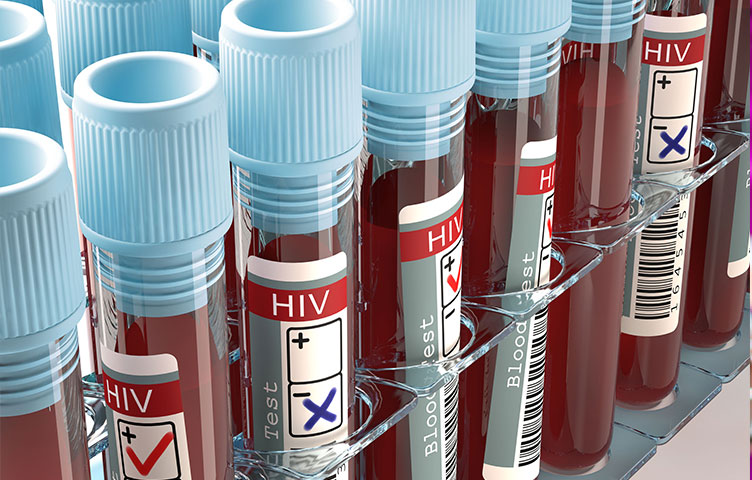 Nhận thức HIV/AIDS và tác dụng phụ của thuốc điều trị nhân ngày Thế giới nhận thức về vắc-xin AIDS