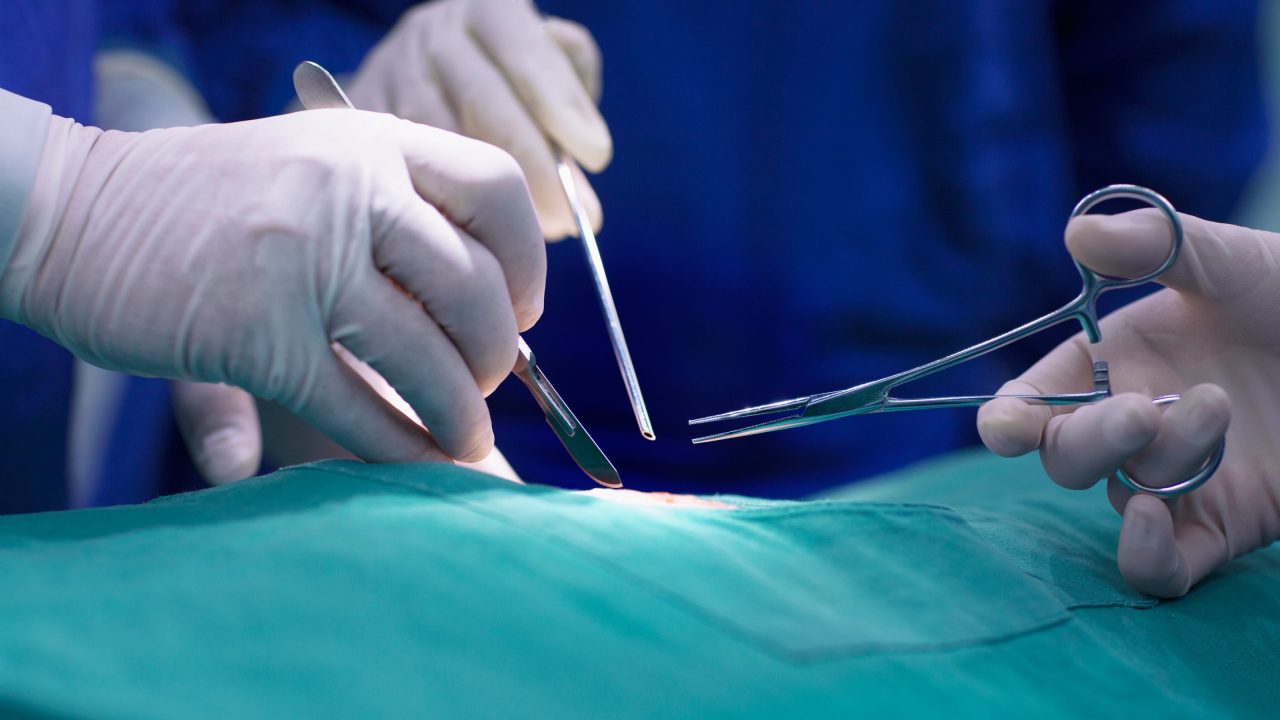 Miếng dán sinh học giúp cầm máu và dán mô trong vài giây, hứa hẹn thay thế chỉ khâu trong phẫu thuật