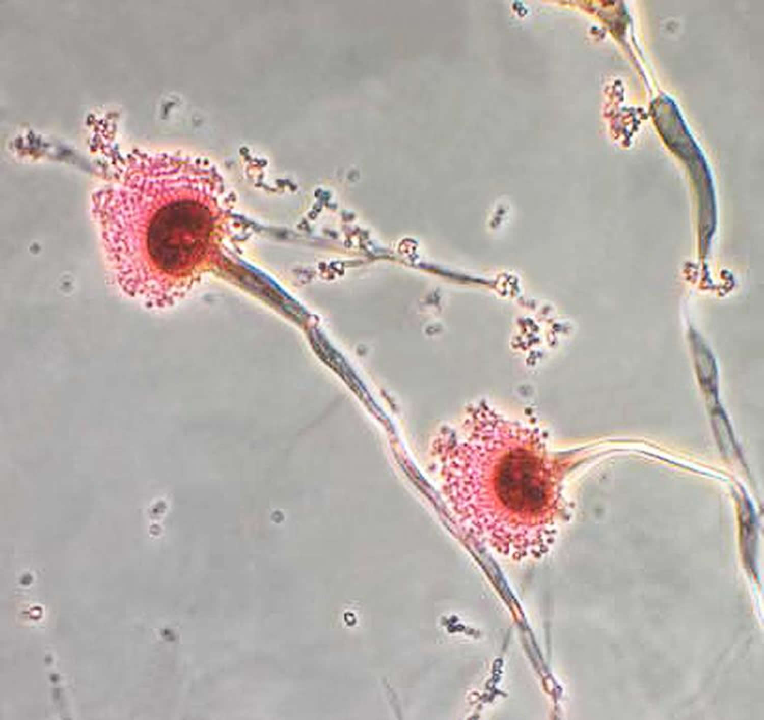 Chủng nấm Aspergillus