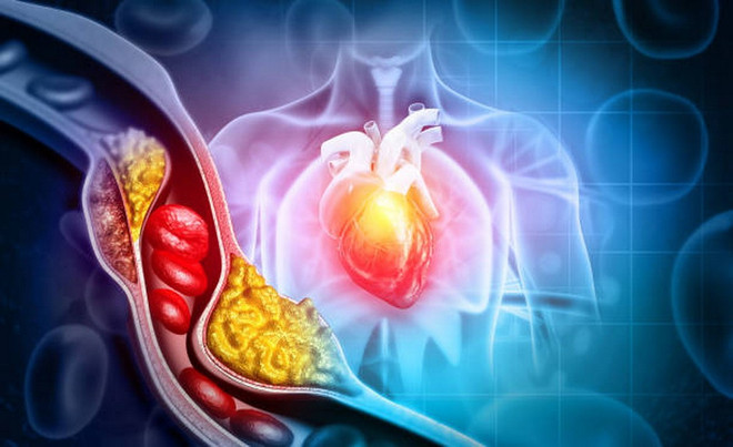 Những thói quen đang âm thầm làm tăng mỡ máu ở người trẻ