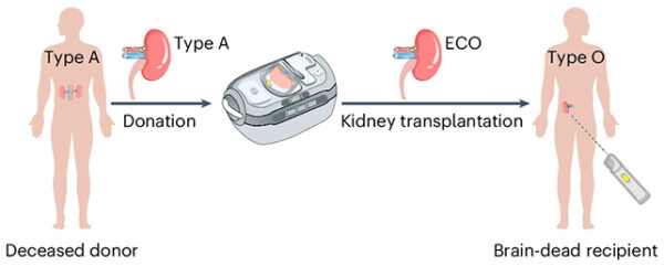 Các nhà nghiên cứu đã thành công chuyển đổi một quả thận loại O (ECO) bằng enzyme, sẵn sàng để cấy ghép