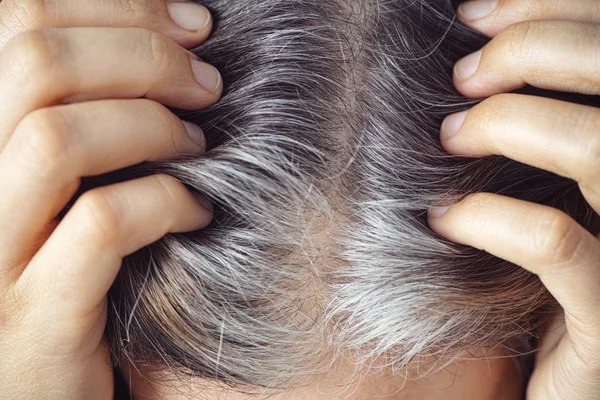 Mỗi sợi tóc bạc có thể là dấu hiệu cơ thể tự bảo vệ khỏi ung thư