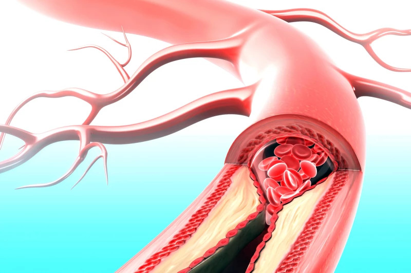 Nghiên cứu loại thuốc “hai trong một”, có thể điều trị đồng thời tiểu đường và bệnh tim