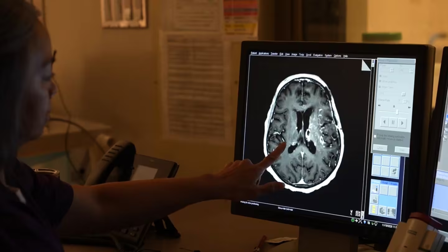 Canada tìm ra kỹ thuật mới giúp bệnh nhân ung thư não sống thêm nhiều năm