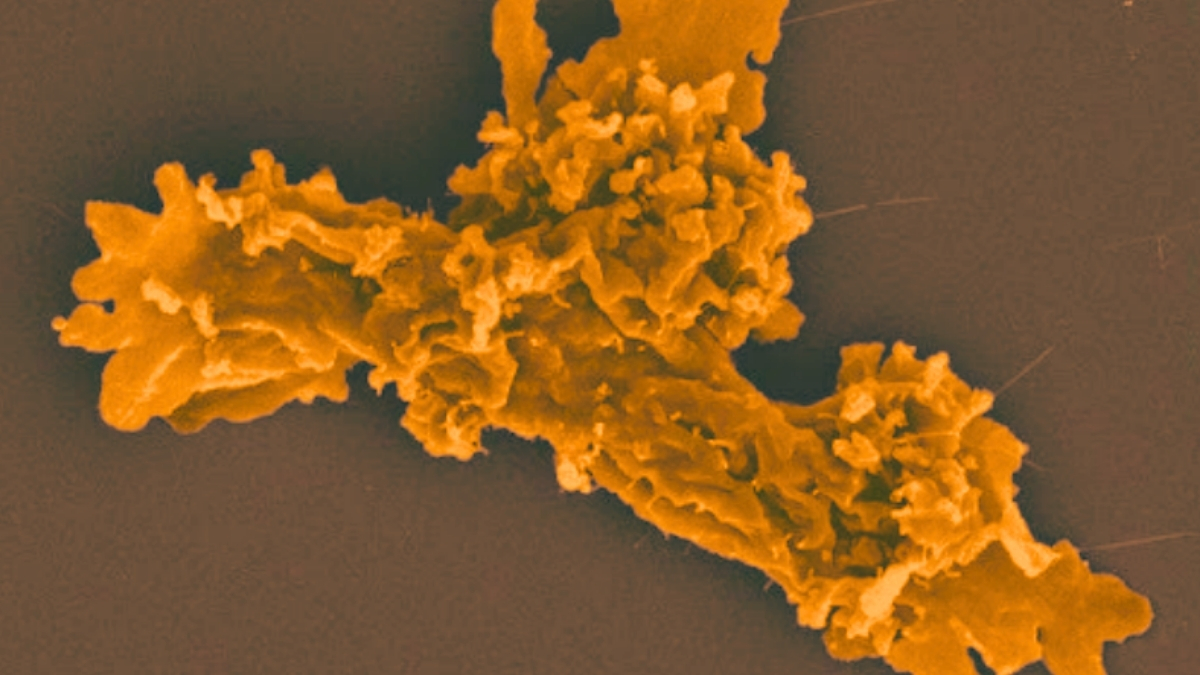 Ảnh chụp của tế bào dạng amip.