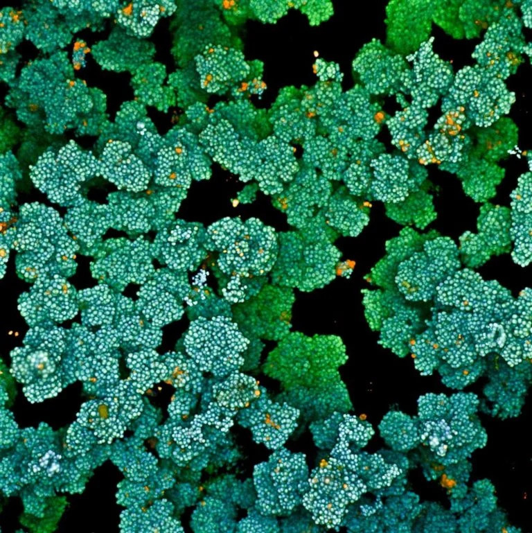 Hình ảnh hiển vi của màng sinh học vi khuẩn, cho thấy cấu trúc phức tạp của các tế bào vi khuẩn.