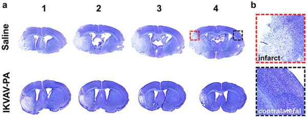 Não bộ của những con chuột được điều trị (hàng dưới) cho thấy ít dấu hiệu tổn thương mô não hơn (các vùng có màu nhạt hơn).