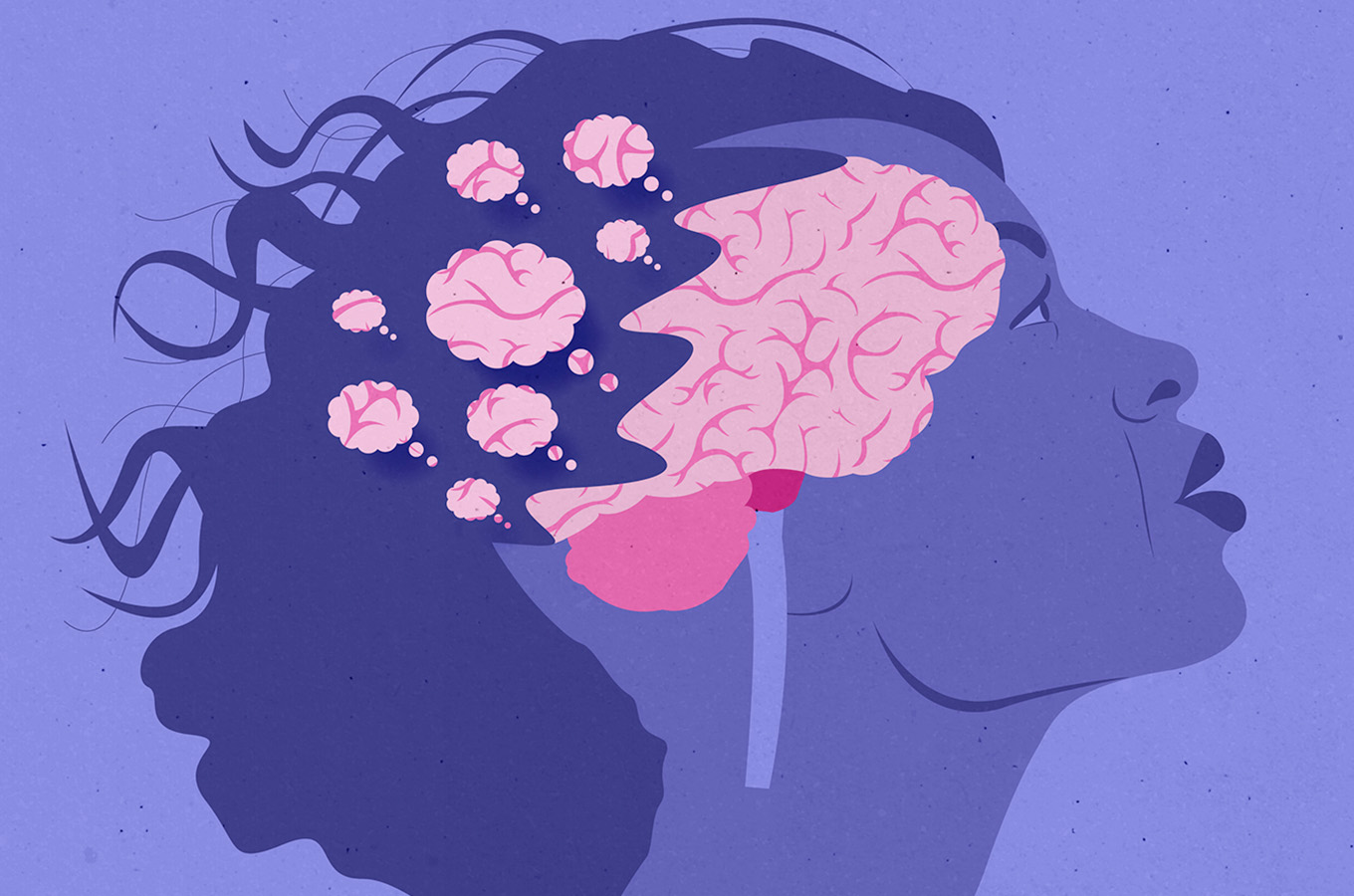 Tình trạng mãn kinh có thể gây biến đổi não tương tự Alzheimer