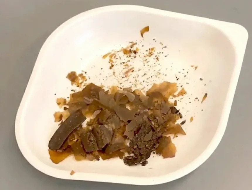 Những mảnh cặn màu nâu được tìm thấy có chứa các hợp chất sinh học đặc trưng của hệ tiêu hóa