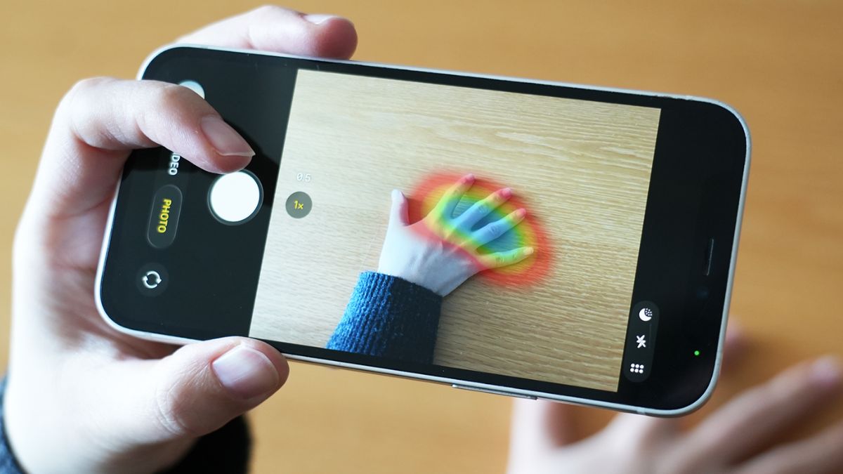 Mô hình AI chẩn đoán chính xác bệnh hiếm chỉ qua hình ảnh bàn tay