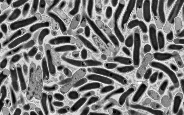 Vi khuẩn E. coli biến đổi gen từ Phòng thí nghiệm của Giáo sư Ron Milo tại Viện Khoa học Weizmann