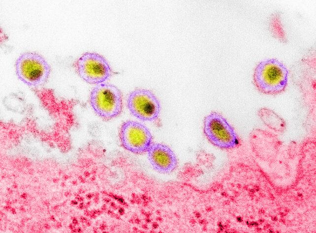 Ảnh hiển vi của vỏ capsid virus HIV-1 (màu tím)