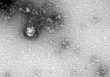 Vì sao biến chủng SARS-CoV-2 lây lan nhanh ở Việt Nam?