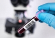 Trứng gà có thể chống lại sự lây nhiễm của coronavirus?