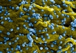 WHO cảnh báo về một virus gây chết người xuất hiện ở châu Phi