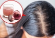 8 biện pháp khắc phục tình trạng rụng tóc