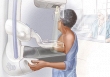 Mỹ khuyến nghị phụ nữ độ tuổi 40 nên tầm soát ung thư vú định kỳ