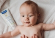 Cách điều trị và chăm sóc viêm da cơ địa vào mùa hè