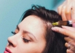 Tạm biệt nỗi lo rụng tóc với liệu pháp mesotherapy