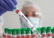 WHO khởi động sáng kiến mới để phát triển vaccine cúm gia cầm mRNA