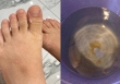 Nước sạch ở khu đô thị Thanh Hà gây mẩn ngứa: Chuyên gia nói về loại độc tố nguy hiểm đến sức khỏe