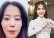 Thẩm mỹ lỗi chi tiết nào trên gương mặt mà khiến Nam Em ngày càng khác lạ và lời khuyên của chuyên gia khi làm đẹp