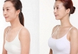 Những nguyên tắc để có một ca nâng ngực 'êm ả'
