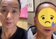 Người đàn ông “lột xác” sau phẫu thuật thẩm mỹ: Nhìn trẻ ra 30 tuổi nhưng ai cũng sợ khi thấy thứ này 