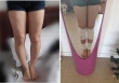 Có thể mất mạng vì kéo chân 'sửa lỗi tạo hóa'