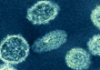 Chuyên gia cảnh báo virus H1N1 ở Trung Quốc có thể gây ra đại dịch