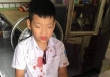 Khởi tố người đàn ông hành hung dã man bé trai lớp 1