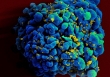 Thế giới có bệnh nhân thứ hai tự khỏi HIV