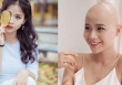 Cô gái chiến thắng ung thư tham gia thi 'Miss World Vietnam'
