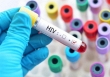 Con đường mới lây nhiễm HIV báo động trong giới trẻ Việt