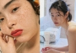 2 thời điểm trong cuộc đời chị em có nguy cơ bị nám da cao nhất