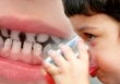 Bé trai 14 tuổi gần như mất cả hàm răng, phải dùng răng giả do nghiện một loại nước nhiều người yêu thích