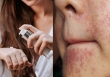 Sẽ thế nào nếu bạn lạm dụng retinol để chống lão hóa da?