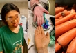 Ăn cà rốt liên tục 3 tháng để giảm cân, cô gái da chuyển vàng như nghệ