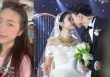 Vợ Đoàn Văn Hậu tự bóc cái giá cho nhan sắc xinh đẹp: Tốn bao nhiêu tiền thẩm mỹ?