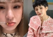 Hiền Hồ lộ diện với vết bầm lớn trên mặt, lại là chiêu trò PR sản phẩm mới?