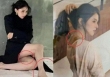 Truyền thông Hoa ngữ đặt nghi vấn Han So Hee bị bạo hành do xuất hiện nhiều vết bầm tím trên cơ thể