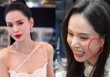 'Tiểu Long Nữ' Lý Nhược Đồng bị nghi vấn 'dao kéo' vì 1 chi tiết lạ trên mặt, nhưng sự thật lại đáng xót xa